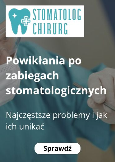 Najczęstsze powikłania po zabiegach stomatologicznych