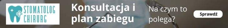 na czym polega konsultacja i planowanie zabiegu?